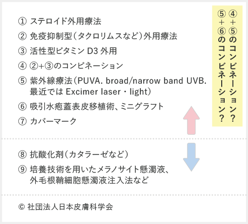 白斑を病院で治療する方法